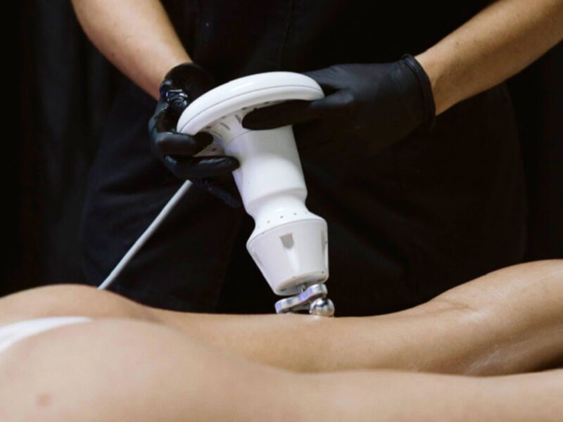 maison-22-esthetique-tecnologie-opt